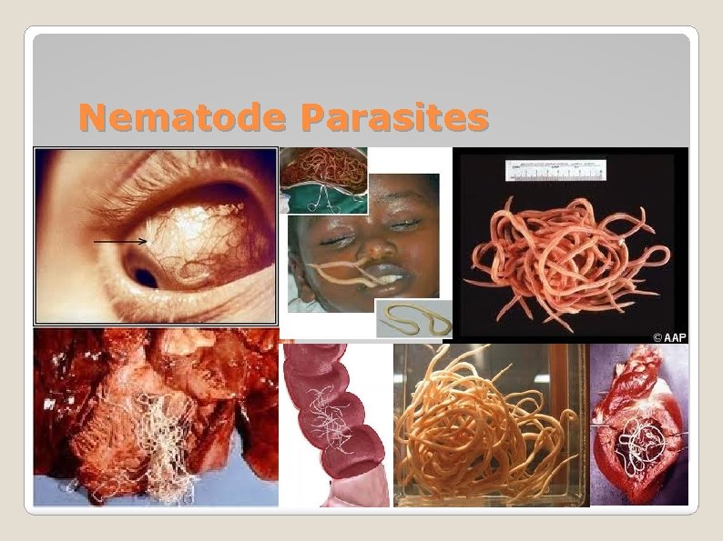 Nematode Parasites 