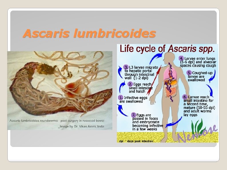 Ascaris lumbricoides 