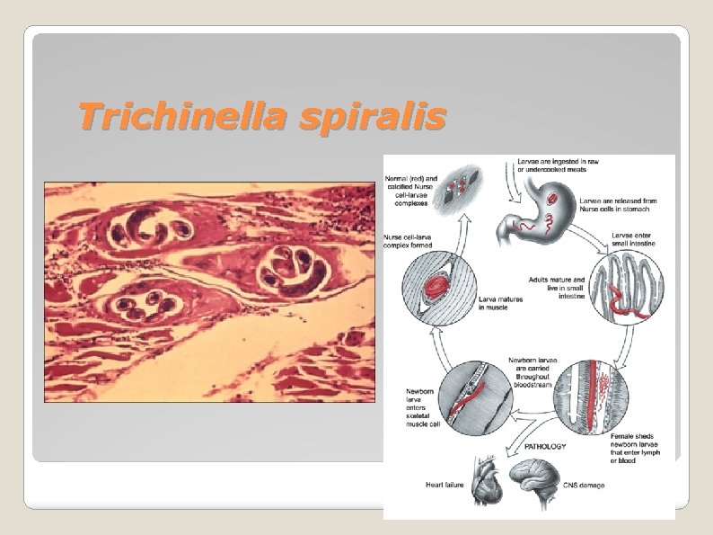 Trichinella spiralis 