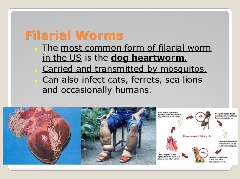 Filarial Worms The most common form of filarial worm in the US is the