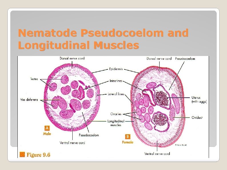 Nematode Pseudocoelom and Longitudinal Muscles 