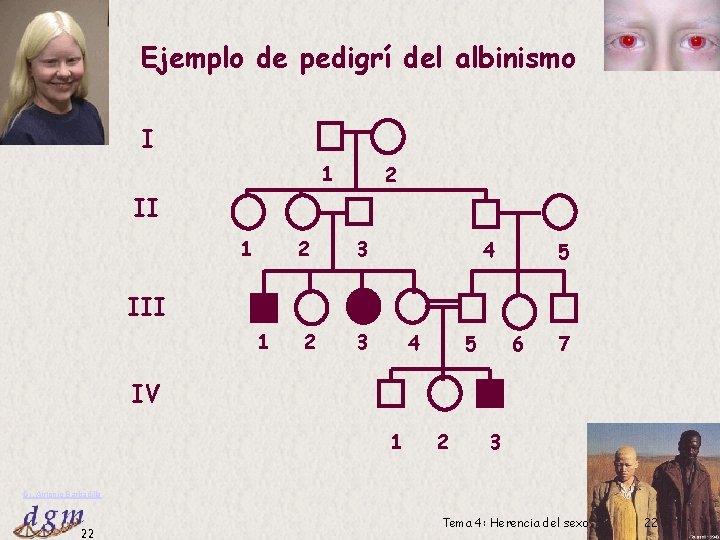 Ejemplo de pedigrí del albinismo I 1 2 II 1 2 3 4 5