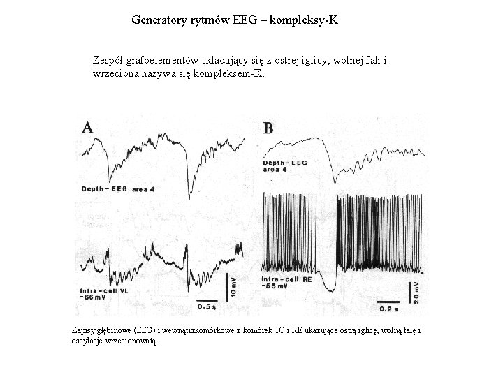 Generatory rytmów EEG – kompleksy-K Zespół grafoelementów składający się z ostrej iglicy, wolnej fali