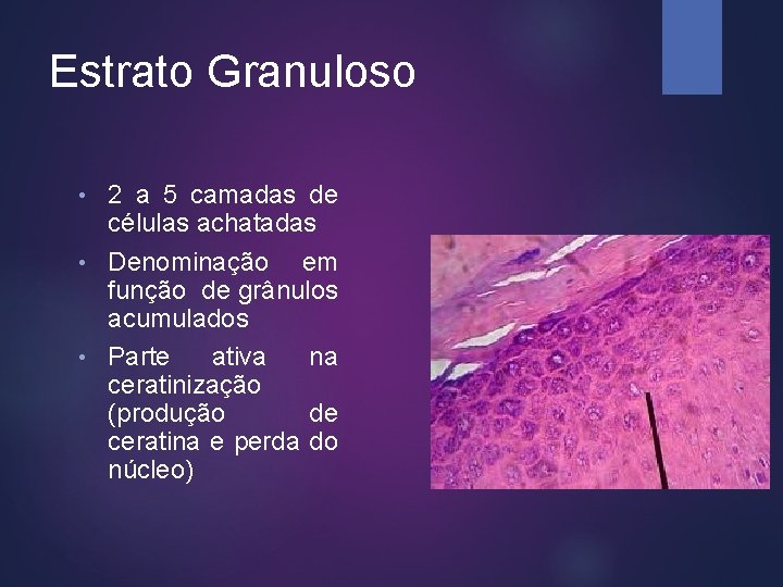 Estrato Granuloso 2 a 5 camadas de células achatadas • Denominação em função de