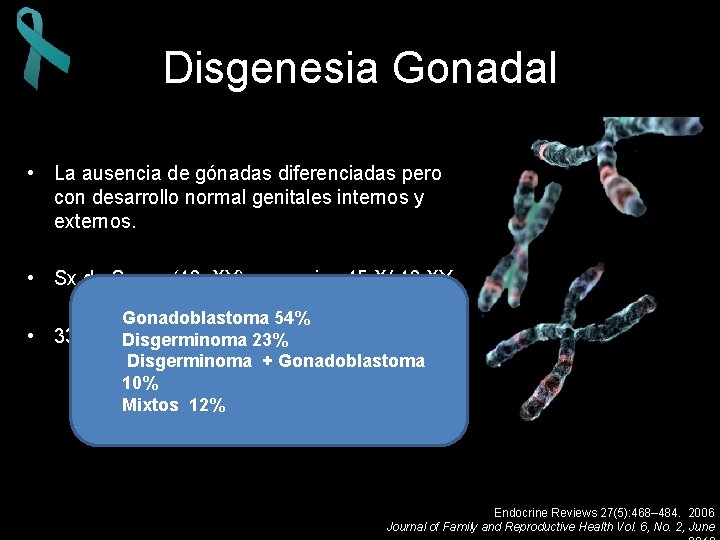 Disgenesia Gonadal • La ausencia de gónadas diferenciadas pero con desarrollo normal genitales internos