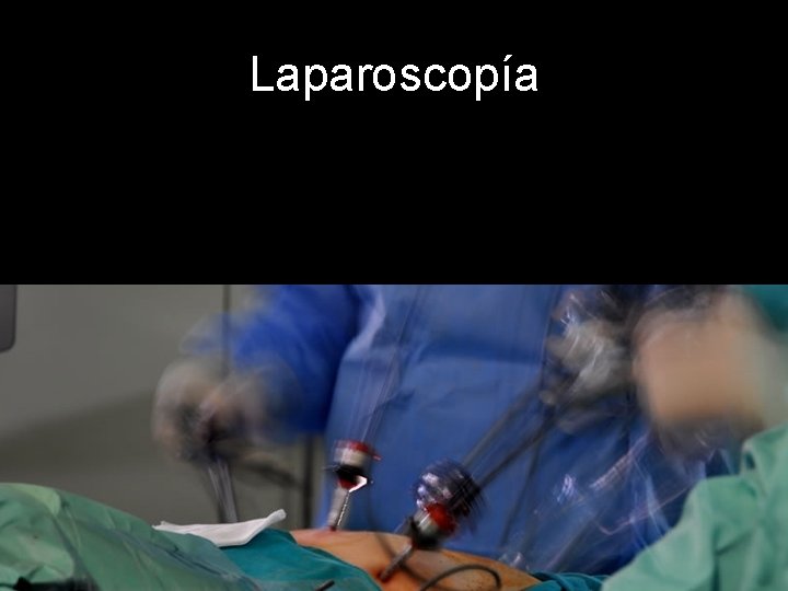 Laparoscopía 