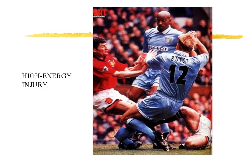 HIGH-ENERGY INJURY HIGH-ENERGY INJURY