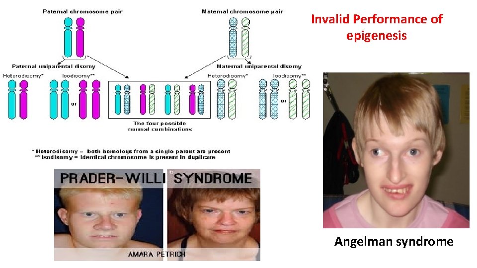 Invalid Performance of epigenesis Angelman syndrome 