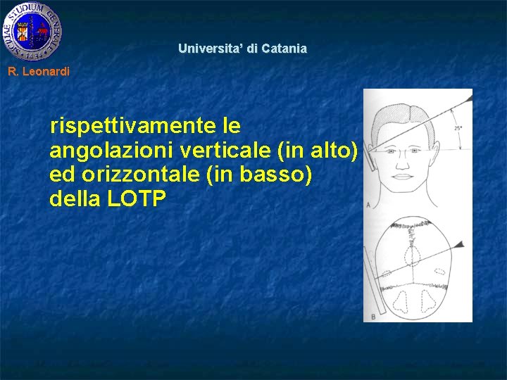 Universita’ di Catania R. Leonardi rispettivamente le angolazioni verticale (in alto) ed orizzontale (in