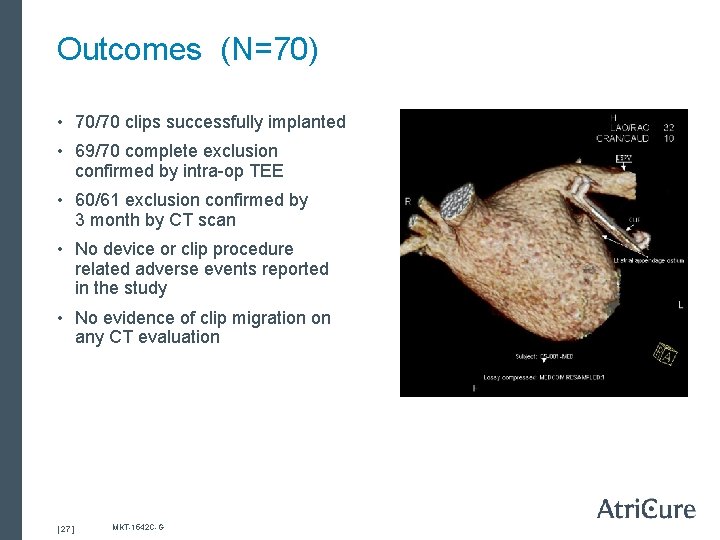 Outcomes (N=70) • 70/70 clips successfully implanted • 69/70 complete exclusion confirmed by intra-op