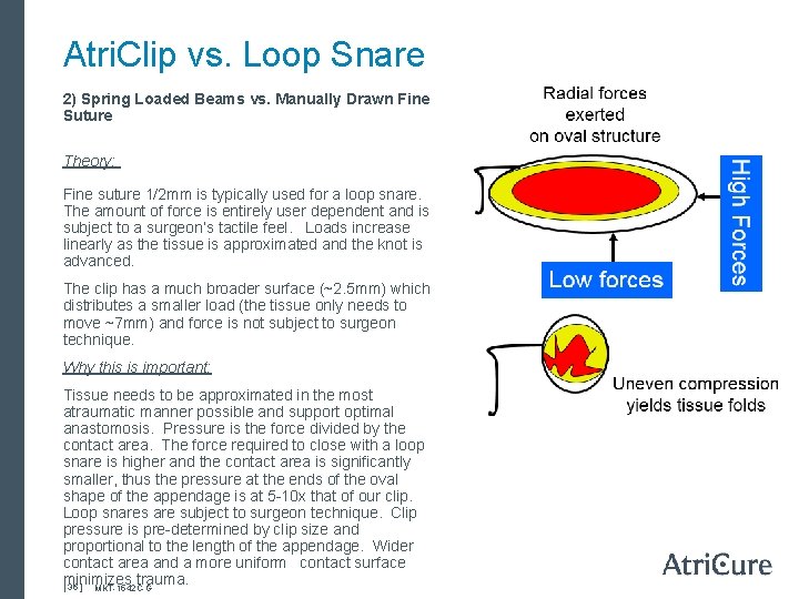 Atri. Clip vs. Loop Snare 2) Spring Loaded Beams vs. Manually Drawn Fine Suture