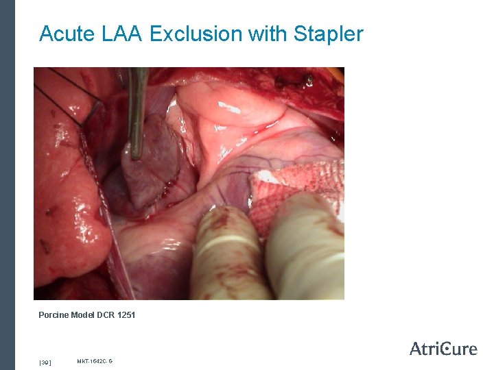 Acute LAA Exclusion with Stapler Porcine Model DCR 1251 [ 39 ] MKT-1542 C-G