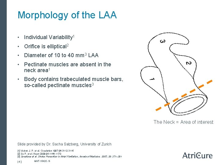 Morphology of the LAA • Individual Variability 1 • Orifice is elliptical 2 •