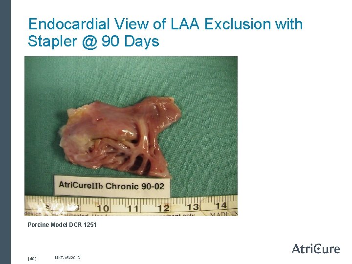 Endocardial View of LAA Exclusion with Stapler @ 90 Days Porcine Model DCR 1251