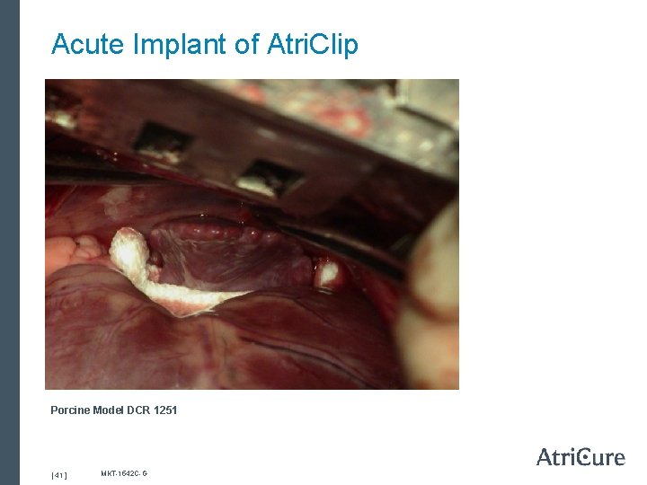 Acute Implant of Atri. Clip Porcine Model DCR 1251 [ 41 ] MKT-1542 C-G