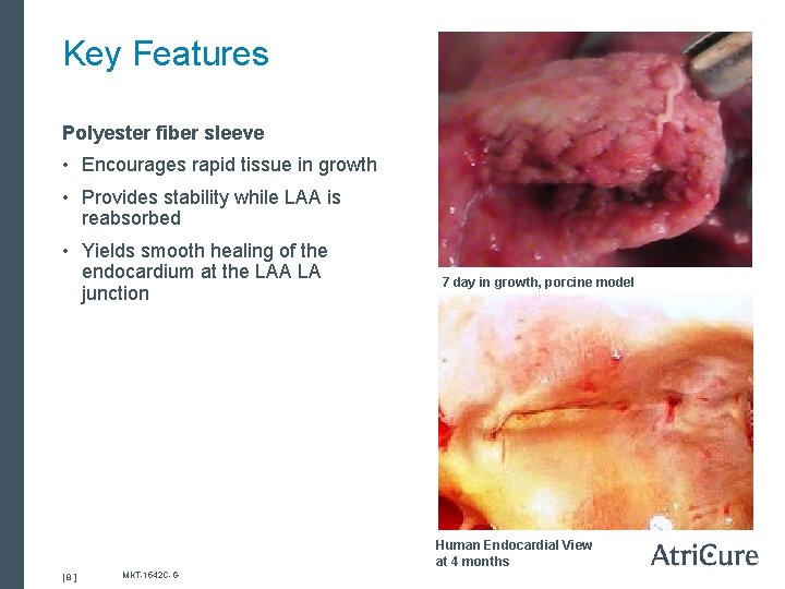 Key Features Polyester fiber sleeve • Encourages rapid tissue in growth • Provides stability