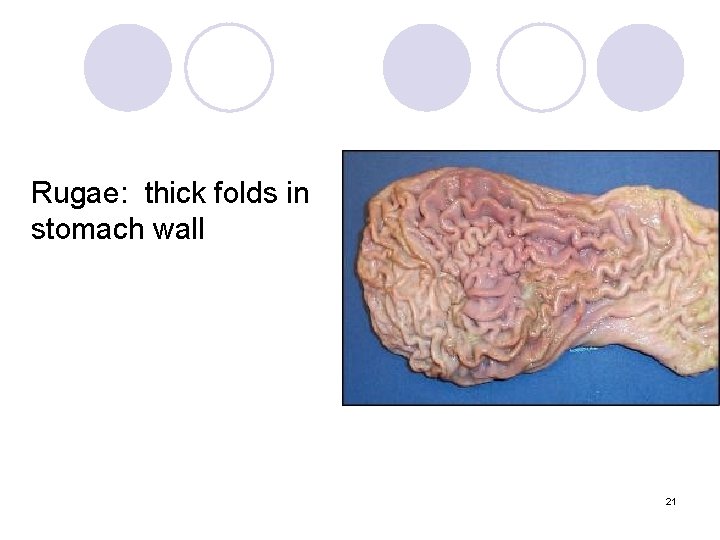 Rugae: thick folds in stomach wall 21 
