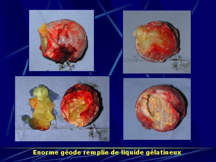 Enorme géode remplie de liquide gélatineux 