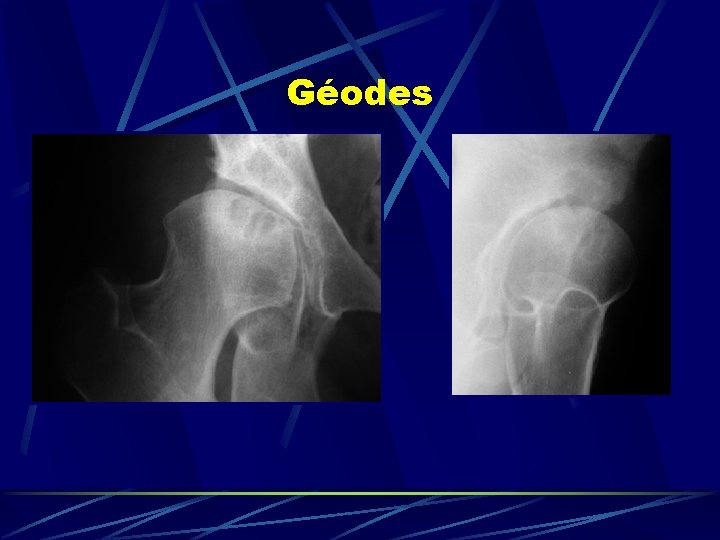 Géodes 