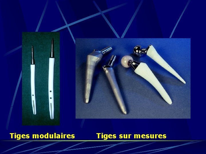 Tiges modulaires Tiges sur mesures 