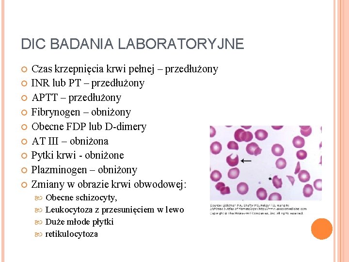 DIC BADANIA LABORATORYJNE Czas krzepnięcia krwi pełnej – przedłużony INR lub PT – przedłużony DIC BADANIA LABORATORYJNE Czas krzepnięcia krwi pełnej – przedłużony INR lub PT – przedłużony