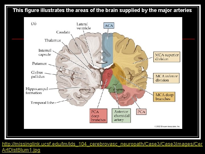 This figure illustrates the areas of the brain supplied by the major arteries http: This figure illustrates the areas of the brain supplied by the major arteries http: