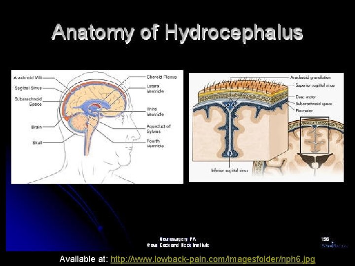 Available at: http: //www. lowback-pain. com/imagesfolder/nph 6. jpg Available at: http: //www. lowback-pain. com/imagesfolder/nph 6. jpg