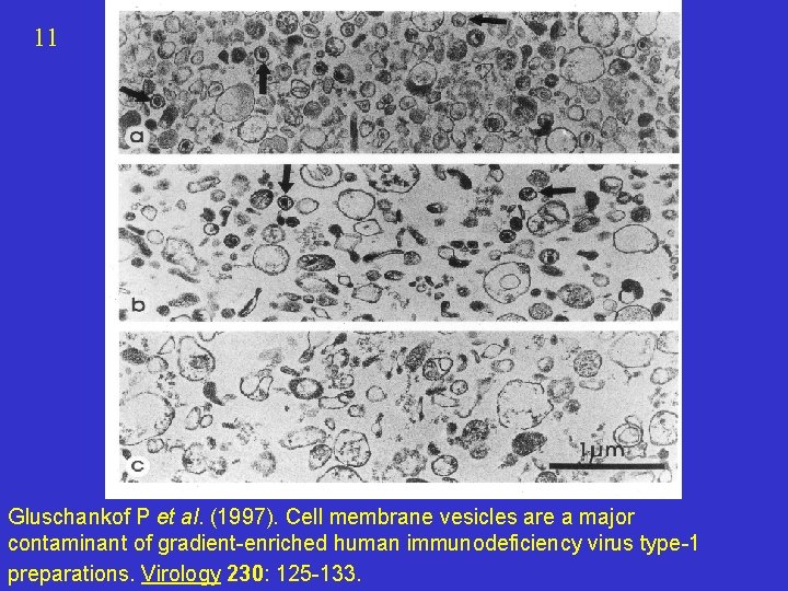 11 Gluschankof P et al. (1997). Cell membrane vesicles are a major contaminant of