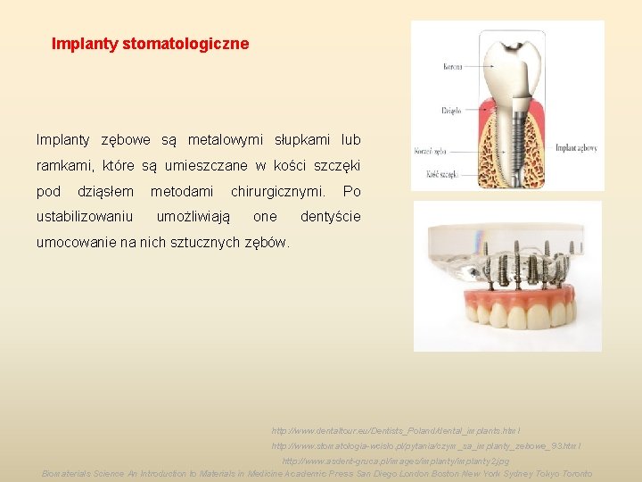 Implanty stomatologiczne Implanty zębowe są metalowymi słupkami lub ramkami, które są umieszczane w kości