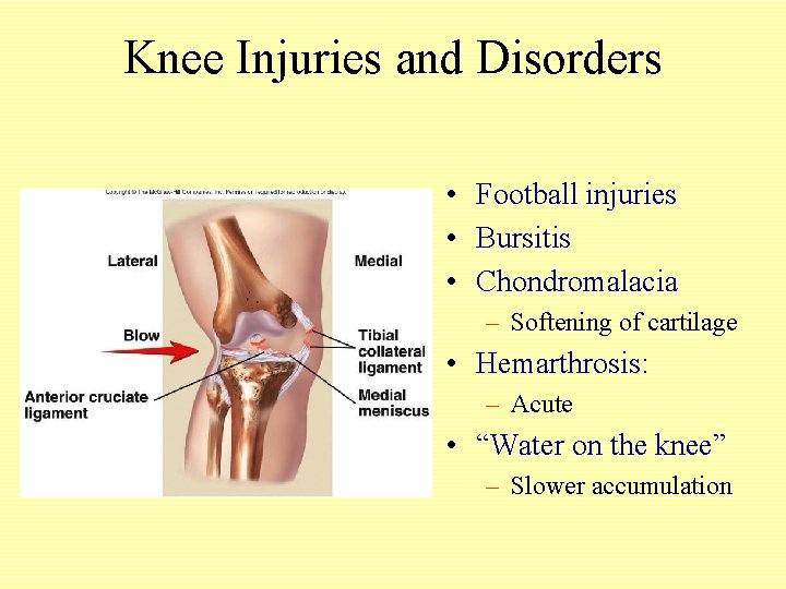 Knee Injuries and Disorders • Football injuries • Bursitis • Chondromalacia – Softening of