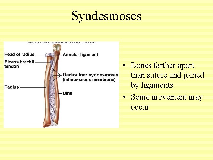 Syndesmoses • Bones farther apart than suture and joined by ligaments • Some movement