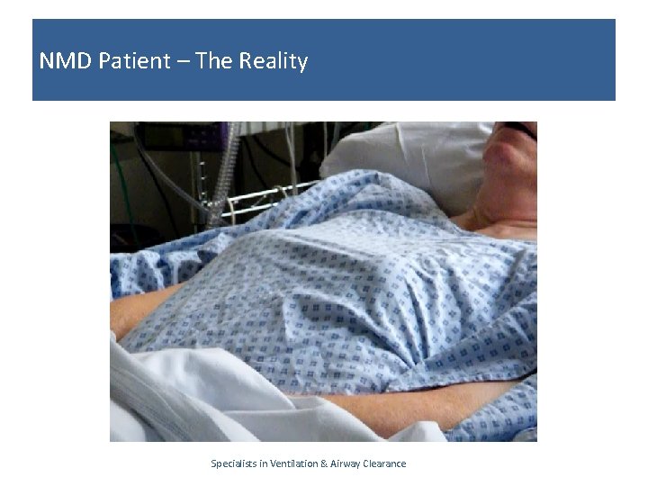 NMD Patient – The Reality Specialists in Ventilation & Airway Clearance 