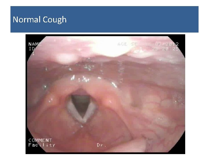 Normal Cough Specialists in Ventilation & Airway Clearance 