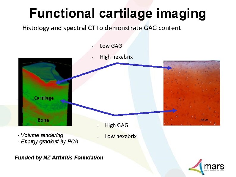 Functional cartilage imaging Histology and spectral CT to demonstrate GAG content • Low GAG