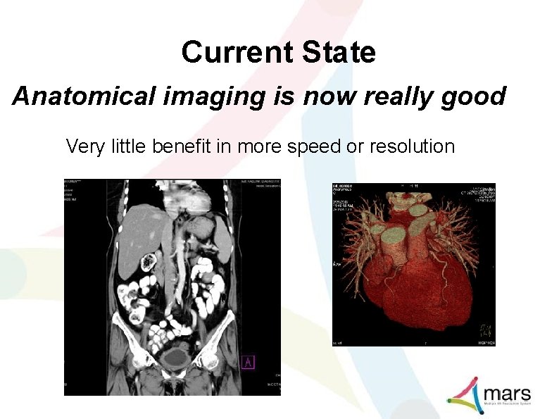Current State Anatomical imaging is now really good Very little benefit in more speed