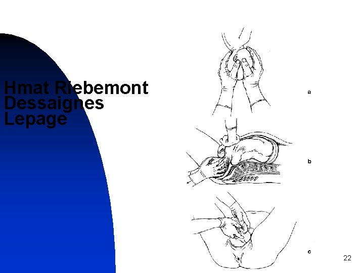 Hmat Riebemont Dessaignes Lepage 22 