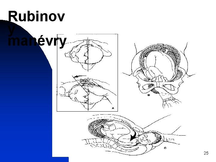 Rubinov y manévry 25 