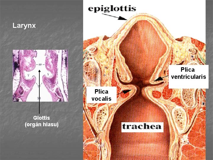 Larynx Plica ventricularis Plica vocalis Glottis (orgán hlasu) 