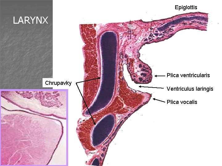 Epiglottis LARYNX Plica ventricularis Chrupavky Ventriculus laringis Plica vocalis 