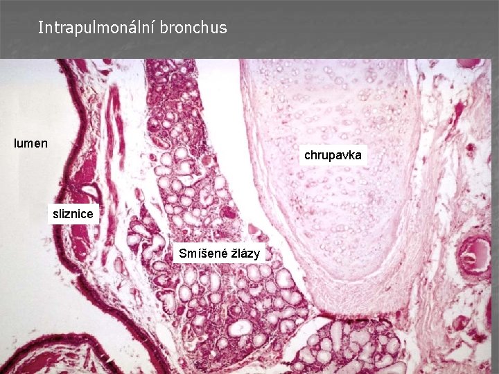 Intrapulmonální bronchus lumen chrupavka sliznice Smíšené žlázy 