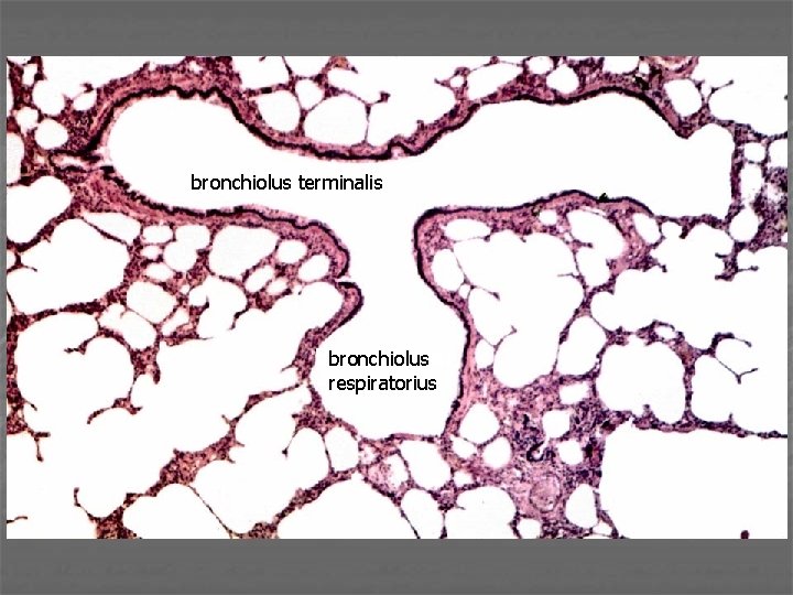 bronchiolus terminalis b. bronchiolus respirační respiratorius 