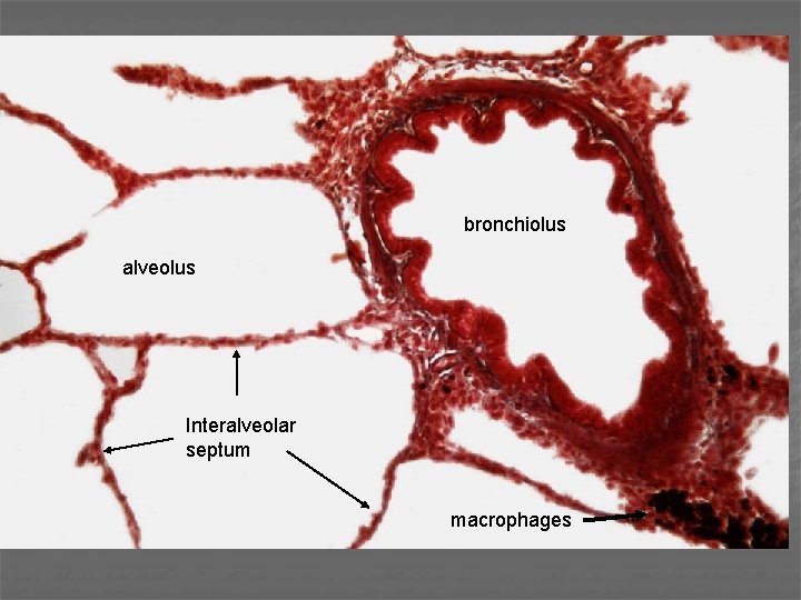 bronchiolus alveolus Interalveolar septum macrophages 