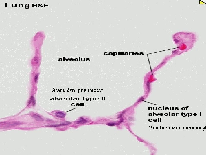 Granulózní pneumocyt Membranózní pneumocyt 