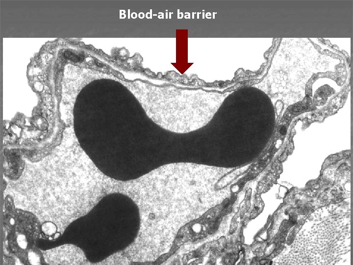 Blood-air barrier 