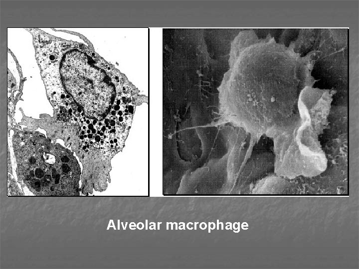 Alveolar macrophage 