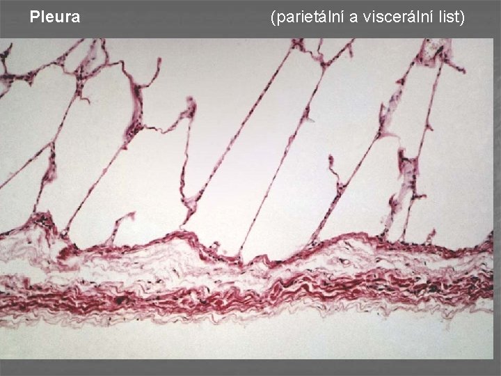 Pleura (parietální a viscerální list) 