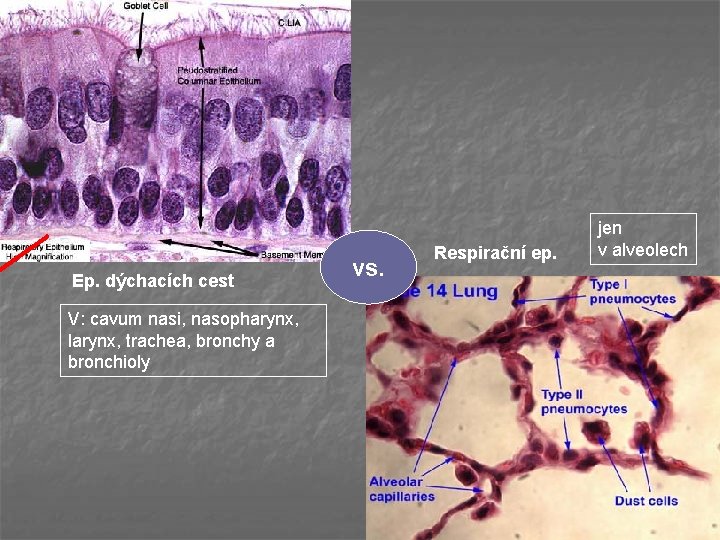 Ep. dýchacích cest V: cavum nasi, nasopharynx, larynx, trachea, bronchy a bronchioly vs. Respirační