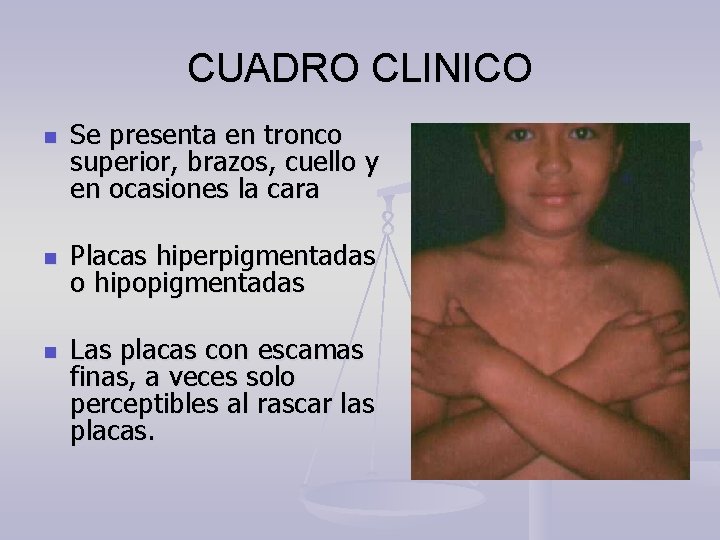 CUADRO CLINICO n n n Se presenta en tronco superior, brazos, cuello y en