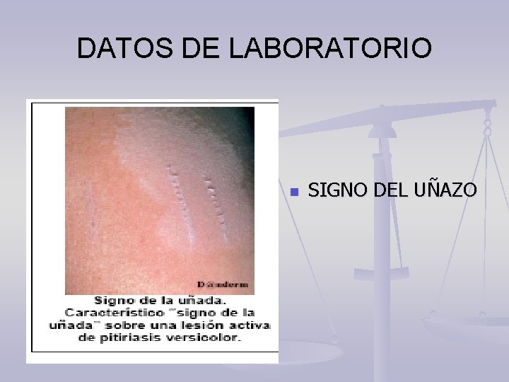 DATOS DE LABORATORIO n SIGNO DEL UÑAZO 