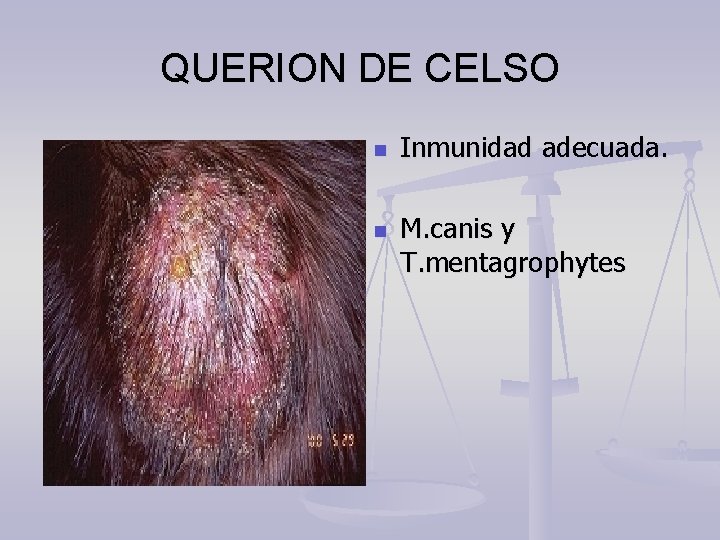 QUERION DE CELSO n n Inmunidad adecuada. M. canis y T. mentagrophytes 